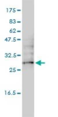 Western Blot UBTD2 Antibody (1B8-1B1) - Azide and BSA Free