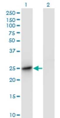 Western Blot UBTD2 Antibody (1B8-1B1) - Azide and BSA Free