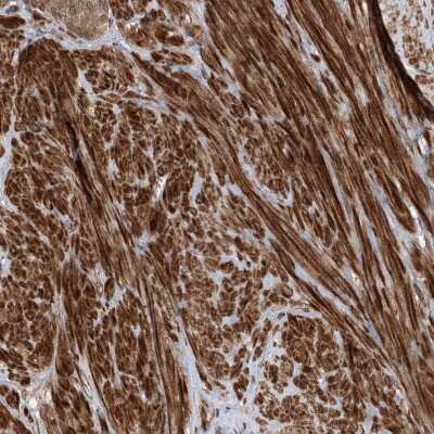 Immunohistochemistry-Paraffin UBTD2 Antibody - BSA Free