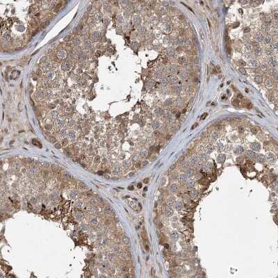 Immunohistochemistry-Paraffin UBTD2 Antibody - BSA Free