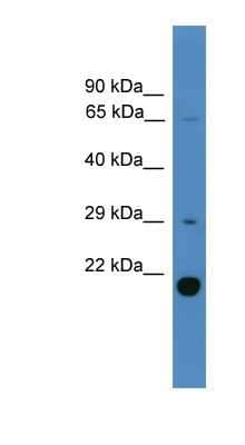 Western Blot: UBTD2 Antibody [NBP1-79759] - Human Liver cell lysate, concentration 0.2-1 ug/ml.