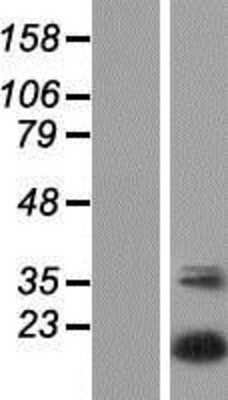 Western Blot: UBTD2 Overexpression Lysate (Adult Normal) [NBP2-05416] Left-Empty vector transfected control cell lysate (HEK293 cell lysate); Right -Over-expression Lysate for UBTD2.