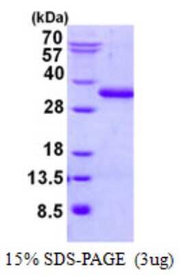 SDS-Page: UBTD2 Protein [NBP2-22919]