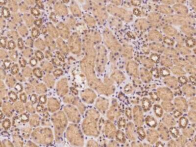 Immunohistochemistry UBXD2 Antibody - BSA Free