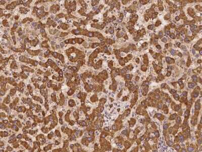 Immunohistochemistry UBXD2 Antibody - BSA Free