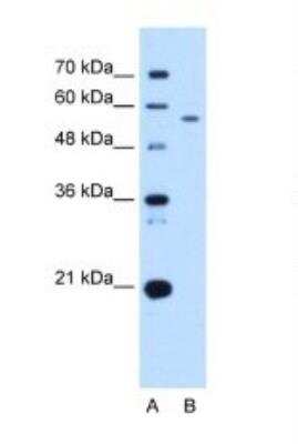 Western Blot: UBXD2 Antibody [NBP1-79240] - Titration: 2.5 ug/ml Positive Control: HepG2 cell lysate.