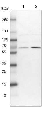 Western Blot: UBXD2 Antibody [NBP1-92560] - Lane 1: NIH-3T3 cell lysate (Mouse embryonic fibroblast cells). Lane 2: NBT-II cell lysate (Rat Wistar bladder tumor cells).