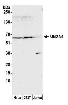 Western Blot: UBXD2 Antibody [NBP2-59141] - Detection of human UBXN4 by western blot. Samples: Whole cell lysate (50 ug) from HeLa, 293T, and Jurkat cells prepared using NETN lysis buffer. Antibody: Affinity purified rabbit anti-UBXN4 antibody NBP2-59141 used for WB at 1:1000. Detection: Chemiluminescence with an exposure time of 30 seconds.