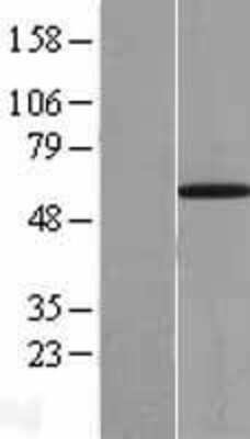 Western Blot: UBXD2 Overexpression Lysate (Adult Normal) [NBL1-17571] Left-Empty vector transfected control cell lysate (HEK293 cell lysate); Right -Over-expression Lysate for UBXD2.