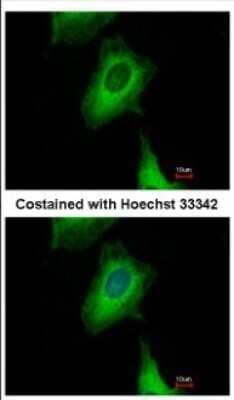 Immunocytochemistry/Immunofluorescence: UBXN1 Antibody [NBP2-20795] - Immunofluorescence analysis of methanol-fixed HeLa, using antibody at 1:500 dilution.
