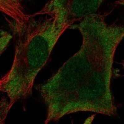 Immunocytochemistry/Immunofluorescence: UBXN1 Antibody [NBP3-17958] - Staining of human cell line SK-MEL-30 shows localization to nucleoplasm & cytosol.