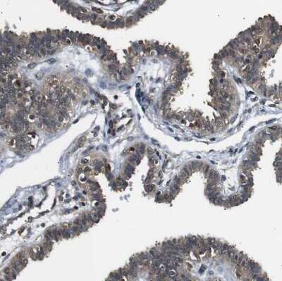 Immunohistochemistry-Paraffin: UBXN1 Antibody [NBP1-89387] - Staining of human fallopian tube shows moderate cytoplasmic positivity in glandular cells.