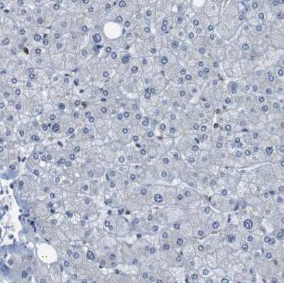 Immunohistochemistry-Paraffin: UBXN1 Antibody [NBP1-89387] - Staining of human liver shows no cytoplasmic positivity in hepatocytes as expected.