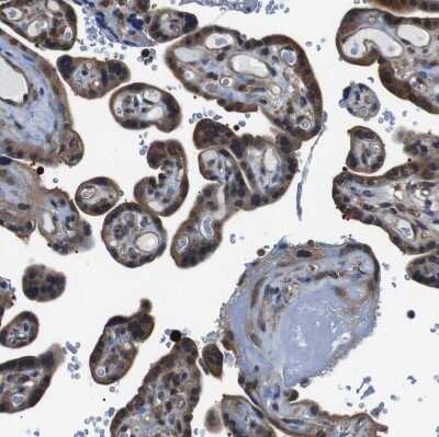 Immunohistochemistry-Paraffin: UBXN1 Antibody [NBP1-89387] - Staining of human placenta shows moderate cytoplasmic positivity in trophoblastic cells.