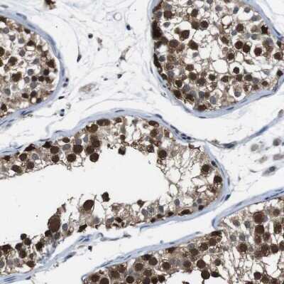 Immunohistochemistry-Paraffin: UBXN1 Antibody [NBP1-89387] - Staining of human testis shows strong cytoplasmic positivity in cells in seminiferous ducts.