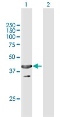 Western Blot: UBXN1 Antibody [H00051035-B01P] - Analysis of UBXN1 expression in transfected 293T cell line by UBXN1 polyclonal antibody.  Lane 1: LOC51035 transfected lysate(34.32 KDa). Lane 2: Non-transfected lysate.