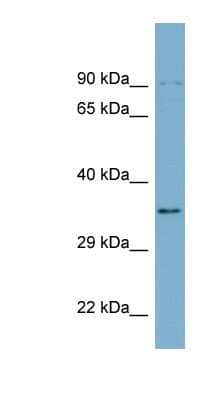 Western Blot: UBXN1 Antibody [NBP1-56353] - Hela cell lysate, concentration 0.2-1 ug/ml.