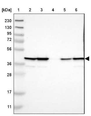 Western Blot: UBXN1 Antibody [NBP1-89387] - Lane 1: Marker  [kDa] 230, 130, 95, 72, 56, 36, 28, 17, 11.  Lane 2: Human cell line RT-4.  Lane 3: Human cell line U-251MG sp.  Lane 4: Human plasma (IgG/HSA depleted).  Lane 5: Human liver tissue.  Lane 6: Human tonsil tissue