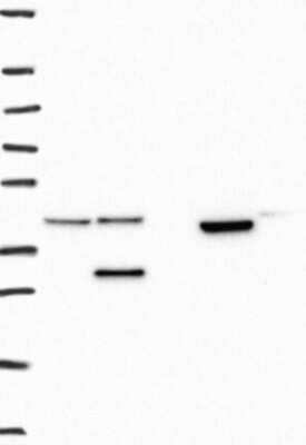 Western Blot: UBXN1 Antibody [NBP3-17958] - Lane 1: Marker [kDa] 250, 130, 95, 72, 55, 36, 28, 17, 10;   Lane 2: RT4;   Lane 3: U-251 MG;   Lane 4: Human Plasma;   Lane 5: Liver;   Lane 6: Tonsil
