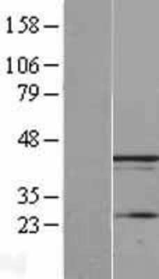 Western Blot UBXN1 Overexpression Lysate