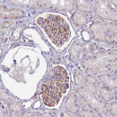 Immunohistochemistry-Paraffin UBXN2B Antibody - BSA Free