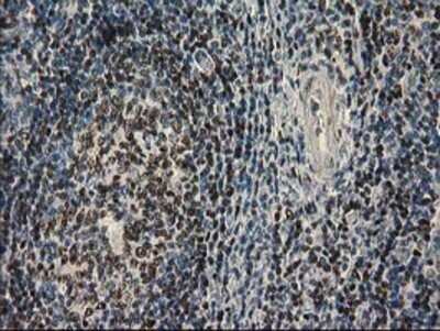 Immunohistochemistry: UBXN2B Antibody (OTI1F7) - Azide and BSA Free [NBP2-74769] - Staining of paraffin-embedded Human lymph node tissue using anti-UBXN2B mouse monoclonal antibody.