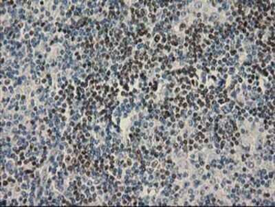 Immunohistochemistry: UBXN2B Antibody (OTI1F7) - Azide and BSA Free [NBP2-74769] - Staining of paraffin-embedded Human lymphoma tissue using anti-UBXN2B mouse monoclonal antibody.