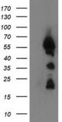 Western Blot: UBXN2B Antibody (OTI1F7) - Azide and BSA Free [NBP2-74769] - HEK293T cells were transfected with the pCMV6-ENTRY control (Left lane) or pCMV6-ENTRY UBXN2B (Right lane) cDNA for 48 hrs and lysed. Equivalent amounts of cell lysates (5 ug per lane) were separated by SDS-PAGE and immunoblotted with anti-UBXN2B.
