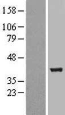 Western Blot: UBXN2B Overexpression Lysate (Adult Normal) [NBP2-08463] Left-Empty vector transfected control cell lysate (HEK293 cell lysate); Right -Over-expression Lysate for UBXN2B.