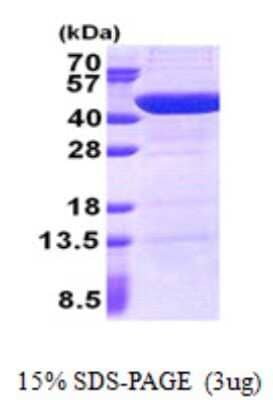 SDS-Page: UBXN2B Protein [NBP2-22927]