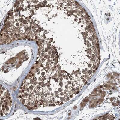 Immunohistochemistry-Paraffin: UBXN6 Antibody [NBP1-80648] - Staining of human testis shows nuclear and cytoplasmic positivity in cells in seminiferous ducts and Leydig cells.