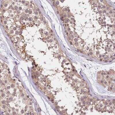 Immunohistochemistry-Paraffin: UBXN6 Antibody [NBP1-80649] - Staining of human testis shows strong cytoplasmic positivity in spermatids.