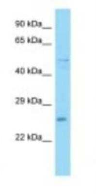 Western Blot: UBXN6 Antibody [NBP1-98481] - Mouse Heart Lysate 1.0ug/ml, Gel Concentration: 12%