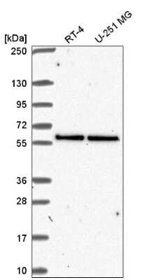 Western Blot: UBXN6 Antibody [NBP2-57653] - Analysis in human cell line RT-4 and human cell line U-251 MG.