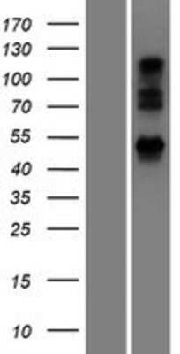 Western Blot: UBXN6 Overexpression Lysate (Adult Normal) [NBP2-06215] Left-Empty vector transfected control cell lysate (HEK293 cell lysate); Right -Over-expression Lysate for UBXN6.