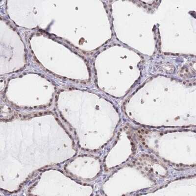 Immunohistochemistry-Paraffin UBXN7 Antibody - BSA Free