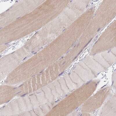 Immunohistochemistry-Paraffin UBXN7 Antibody - BSA Free