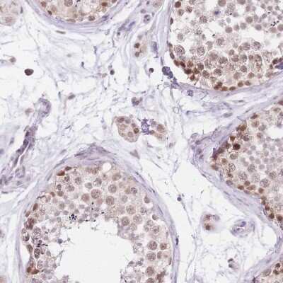 Immunohistochemistry-Paraffin UBXN7 Antibody - BSA Free