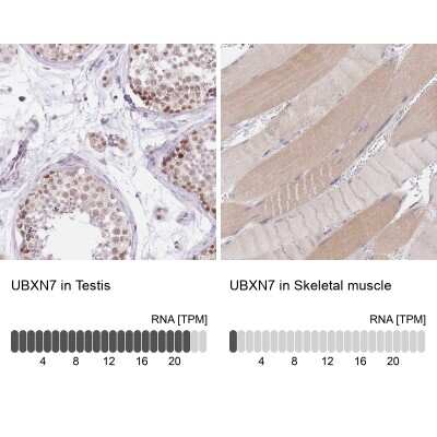 Immunohistochemistry-Paraffin UBXN7 Antibody - BSA Free