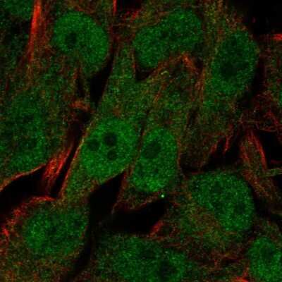 Immunocytochemistry/Immunofluorescence: UBXN8 Antibody [NBP2-57881] - Staining of human cell line SK-MEL-30 shows localization to nucleoplasm & endoplasmic reticulum.