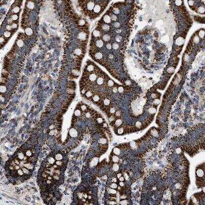Immunohistochemistry-Paraffin: UBXN8 Antibody [NBP2-76517] - Staining of human small intestine shows strong cytoplasmic positivity in glandular cells.