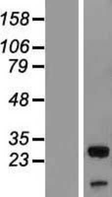 Western Blot UBXN8 Overexpression Lysate
