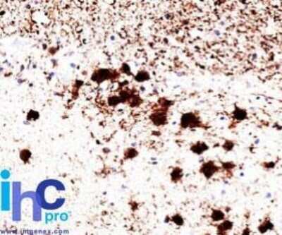 Immunohistochemistry-Paraffin: UCH-L1/PGP9.5 Antibody (31A3) - Azide and BSA Free [NBP2-33130] - Formalin-fixed, paraffin-embedded human brain stained with UchL1 antibody (PGP9.5) (1:500), peroxidase-conjugate and DAB chromogen. Staining seen in cytoplasm, ER and membrane.  Fixation in 95% ethanol/5% acetic acid for 2-3 hours prior to paraffin embedd