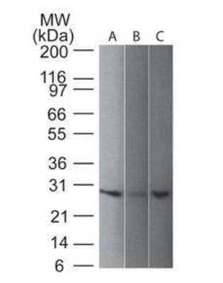Western Blot: UCH-L1/PGP9.5 Antibody (31A3) - Azide and BSA Free [NBP2-33130] - analysis of UchL1 in 1) human, 2) mouse and 3) rat brain lysate using UchL1 antibody at 1 ug/ml.  goat anti-mouse Ig HRP secondary antibody and ECL substrate solution were used for this test.