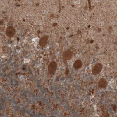 Immunohistochemistry-Paraffin: UCH-L1/PGP9.5 Antibody (CL3210) [NBP2-46621] - Analysis of human cerebellum shows moderate positivity in Purkinje cells.