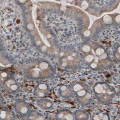 Immunohistochemistry-Paraffin: UCH-L1/PGP9.5 Antibody (CL3210) [NBP2-46621] - Analysis of human duodenum shows staining in peripheral nerve fibers.