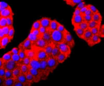 Immunocytochemistry/Immunofluorescence: UCH-L1/PGP9.5 Antibody (JF93-08) [NBP2-66760] - Staining PGP9.5 in PC-12 cells (red). The nuclear counter stain is DAPI (blue). Cells were fixed in paraformaldehyde, permeabilised with 0.25% Triton X100/PBS.