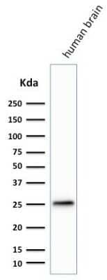 Western Blot: UCH-L1/PGP9.5 Antibody (SPM574) [NBP2-32895] - Western Blot Analysis of human Brain lysate using UCH-L1/PGP9.5 Antibody (SPM574)