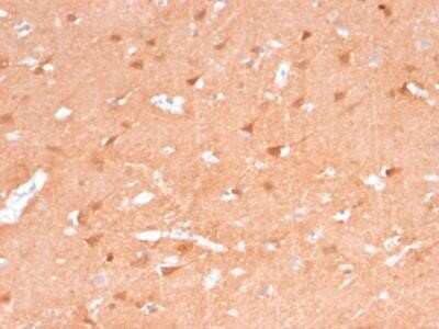 Immunohistochemistry-Paraffin: UCH-L1/PGP9.5 Antibody (rUCHL1/775) - Azide and BSA Free [NBP2-75775] - Formalin-fixed, paraffin-embedded Human Brain stained with Pgp9.5 Mouse Recombinant Monoclonal Antibody (rUCHL1/775).