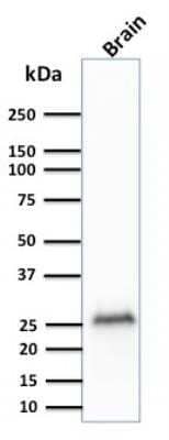 Western Blot: UCH-L1/PGP9.5 Antibody (rUCHL1/775) - Azide and BSA Free [NBP2-75775] - Analysis of Human Brain tissue lysate using Pgp9.5 Mouse Recombinant Monoclonal Antibody (rUCHL1/775).